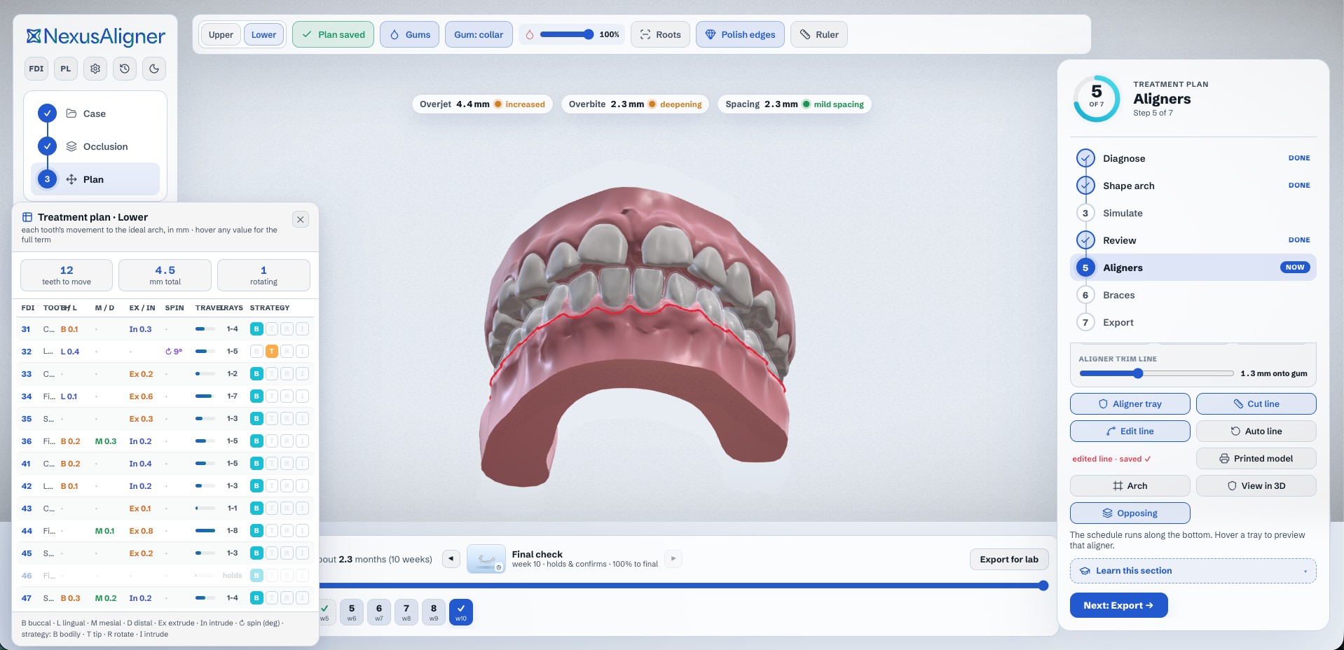 The NexusAligner planning workspace, showing the case steps, the 3D occlusion with the aligner trim line, and the per-tooth movement table.